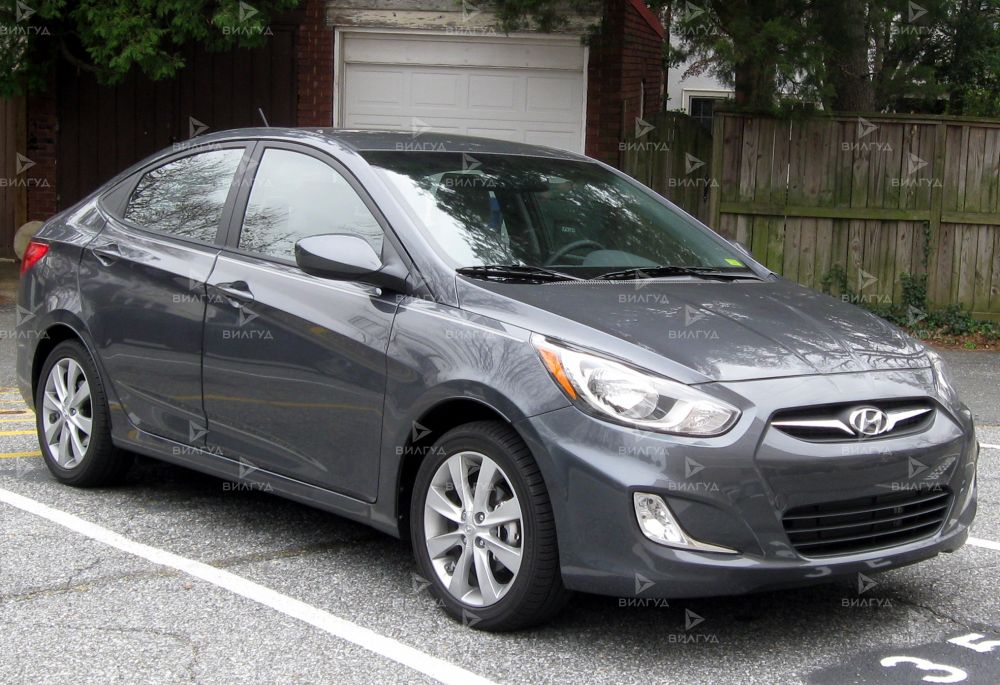 Ремонт дизеля Hyundai Accent в Челябинске